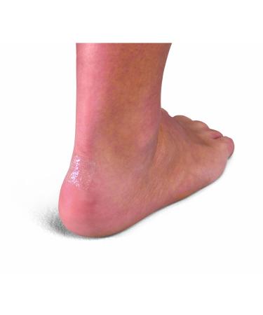 More Skin - 1" Square - 75 (PAC)