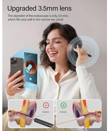Bebird Ear Cleaner with Camera - 1080p Otoscope for Ear Wax Removal Kit - Buy Online on GoSupps.com