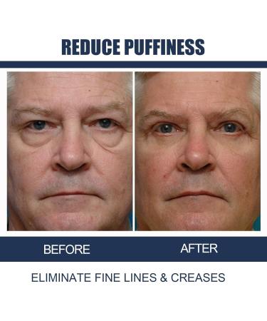 OPENEYES Awaken Peptide Lifting Eye Gel Openeyes Peptide Eye Gel Open Eyes Peptide Openeyes Lifting Eye Gel Men Eye Cream for Dark Circles and Puffiness (4Pcs) - Buy Online on GoSupps.com