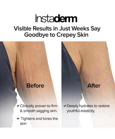 Instaderm Crepe Fix Body Restorative Cream Anti-Aging Wrinkle Cream Support Skins Natural Elastin & Collagen Production to Restore Lift Tighten Hydrate & Smooth Thinning Aged Crepey Skin. 4OZ - Buy Online on GoSupps.com