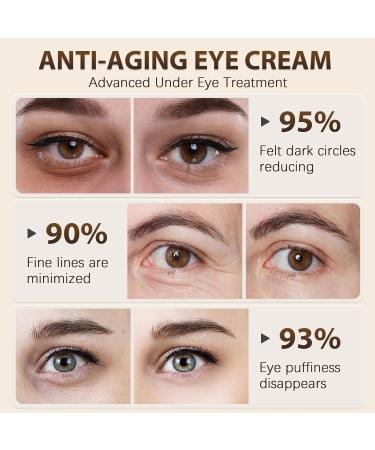 Vitality-Fill Boosting Eye Cream | Natural Anti-Aging Eye Treatment for Wrinkles Dark Circles & Puffiness | 0.5 Fl Oz - Buy Online on GoSupps.com