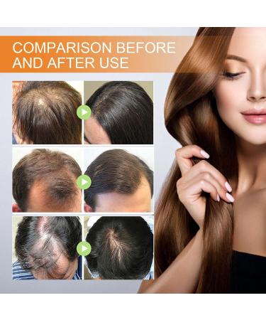 Pumpkin Seed Oil For Hair Growth 60ML Organic Pumpkin Seed Oil For Hair Eyebrow & Eyelash Growth Skin Care Pumpkin Oil For Hair Growth Improve Hair Loss and Nourishes Scalp Non-greasy (1PC) - Buy Online on GoSupps.com