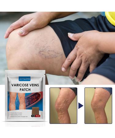 XIYINLI 12pcs Varicose Veins Patches | Skin-Friendly & Non-Toxic Relief for Swelling & Pain - Buy Online on GoSupps.com