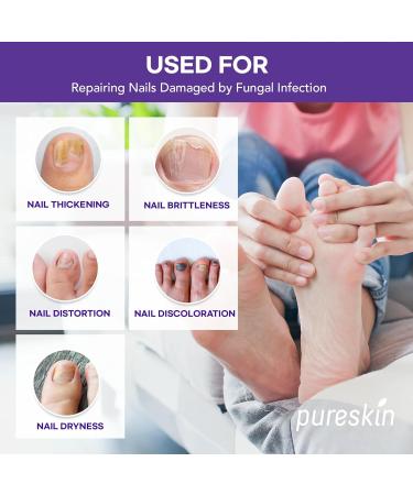 Extra Strength Toenail Fungus Treatment Patches | 21 Effective Overnight Nail Repair Patches - Buy Online on GoSupps.com
