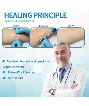 Emergency Laceration Closures - Zipstitch Wound Closure Device (4 Set) | Easy Use No Stitches Ideal for Home & Outdoors - Buy Online on GoSupps.com