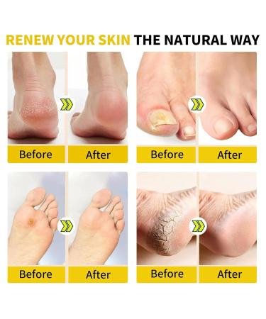 2023 Detoxing Herbs Cleansing Foot Soak Beads - Weight Loss & Foot Bath Relief - Buy Online on GoSupps.com