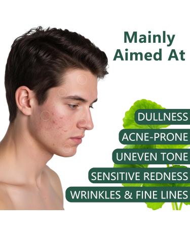 YAMFIUY Centella Moisturizer Phytocin Cream - Phytocin Cream Moisturizer & Hydration Improve Roughness Smooth Skin For Sensitive Skin with Natural Centella Asiatica Extract 2pcs - Buy Online on GoSupps.com