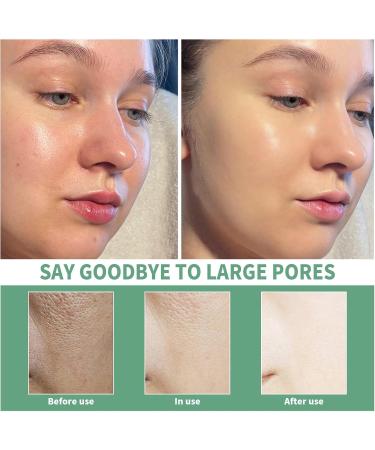 Centella Asiatica Face Serum for Women Centella Asiatica Extract Facial Serum Centella Serum for Calming Soothing Skincare Moisturiser Hydrating Serum Centella Moisturiser Brightening Serum 100ml - Buy Online on GoSupps.com