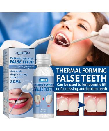 Kings Temporary Tooth Repair 40g - Thermal Operlen Tooth Filling & Temporary Veneer for Broken Tooth Fixing - Buy Online on GoSupps.com