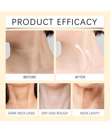  JIAOY Set of 4 Bee Venom Neck Firming Pencils - Firms and Lifts Sagging Skin - Bee Venom Wrinkle Elimination Cream - Anti-Aging Moisturizing Cream - Hydrating Lifting - Buy Online on GoSupps.com