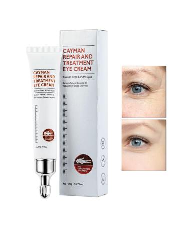 CAHIUYOA Eye Cream for Dark Circles and Puffiness Firm That Delicate Skin Under Your Eyes