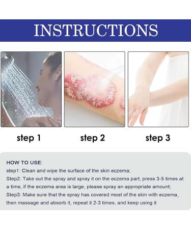 SHEDIAO South Moon Psoriasis Relief Spray - Herbal Treatment for Skin Plaque Psoriasis (5PCS) - Buy Online on GoSupps.com