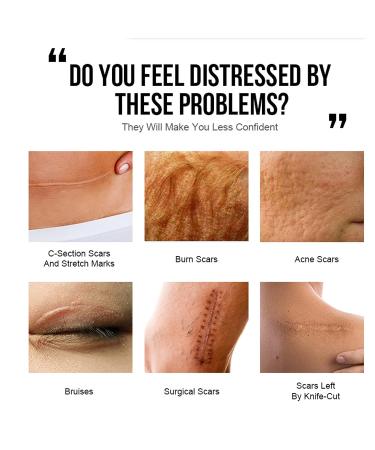Scar Removal Cream 40g - Non-Oily Formula for Face & Body | Stretch Marks, Burns, & Scars Treatment - Buy Online on GoSupps.com