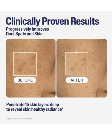 Cetaphil Healthy Radiance Brightening Serum with Niacinamide for Skin Pigmentation 30ml - Buy Online on GoSupps.com