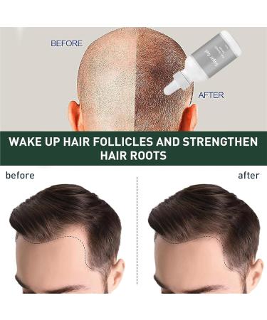 Gel d soxyribose au sucre pour la croissance des cheveux pour le traitement de la perte de cheveux favorise la repousse et r duit la croissance des cheveux gel de sucre pour cheveux (2 pi ces) 2 pi ces. - Buy Online on GoSupps.com