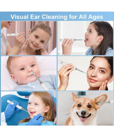Ear Wax Removal Ear Cleaner Ear Camera 1296P HD Ear Wax Removal Tool Ear Cleaner Ear Wax Remover Otoscope with 8 Replacement Ear Set 6 LED Lights 3.5mm Waterproof Visual Ear Scope for iPad & Android - Buy Online on GoSupps.com