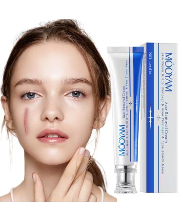 Scar Cream Scar Removal Cream Advanced Scar Treatment For Face and Body Repair Scar Cream for Keloid C-Section Surgery Burns Acne Etc Old and New Scars Scar Removal for Women 30g / 1.06 fl oz