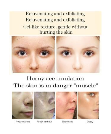 AICHUN BEAUTY Snail Peeling Gel - Deep Clean & Moisturize Face & Body | Anti-Aging Keratin Removal | Refresh Smooth Skin - International Shipping Available - Buy Online on GoSupps.com