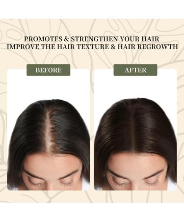 100% Pure Batana Oil for Hair Growth | Organic Dr. Sebi Oil from Honduras | Enhance Hair Thickness & Scalp Care | 4.23 fl oz - Buy Online on GoSupps.com