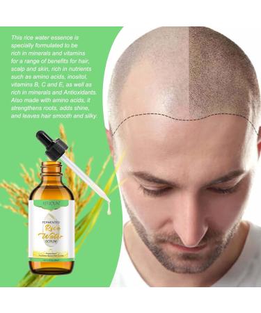 Rice Essential Water Oil for Hair Growth Thickness Strength Shine -100% Pure Natural Leave-in Conditioner for Scalp Dry Split End Moisturizer - Rice Water Oil for Hair Growth&Hair Loss - Buy Online on GoSupps.com