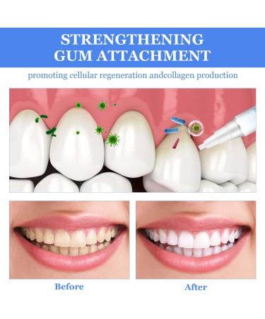 BSOON Gums Therapy Gel - 3 Tooth Whitening Pins & Gum Shield | Teeth Whitening Essence for Stain Removal - Buy Online on GoSupps.com