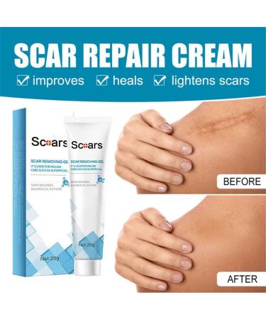  Anshka Organic scar removal gel natural scar therapeutic gel scar removal cream for old scars scar repair gel cream for men and women 1 piece - Buy Online on GoSupps.com