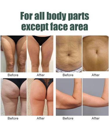 Zonewd Collagen Oil - 50ml Moisturizing Body Oil for Skin Tightening | Lifting Oil for Neck Stomach Thighs & More - Best Body Moisturizer - Buy Online on GoSupps.com