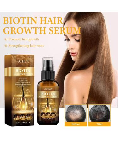 Buy Biotin Hair Growth Spray - 30ml Essential Oil for Fast Hair Growth & Skin Care | Multicolor International Shipping - Buy Online on GoSupps.com