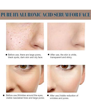 Hyaluronic Acid Serum for Hydrated Hyaluronic Acid For Face Hydrated Hyaluronic Acid Serum for Face Lightweight Face Serum Plump and Smooth Skin for All Skin Types Skin Care - Buy Online on GoSupps.com