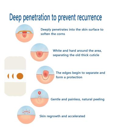 Gelanori Corn Removers for Feet and Toe - 20pcs Foot Care Corn Pads - Buy Online on GoSupps.com