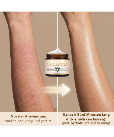 LHUDILS Tallow Bee Cream Bienengiftsalbe 130g Face Care AntiAging Wrinkle Reduction Muscle Pain Relief MindBody Improvement Bienengiftsalbe Moisturizing Skin Rejuvenation Tallow Creme - Buy Online on GoSupps.com