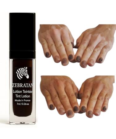 Lotion Maquillage Vitiligo 7ml Masque les Taches Blanches sur la Peau Camouflage Naturel Non Gras pas un fond de teint Hommes Femmes & Enfants Autobronzant Vegan Teinte marron moyen 7 ml (Lot de 1) marron moyen