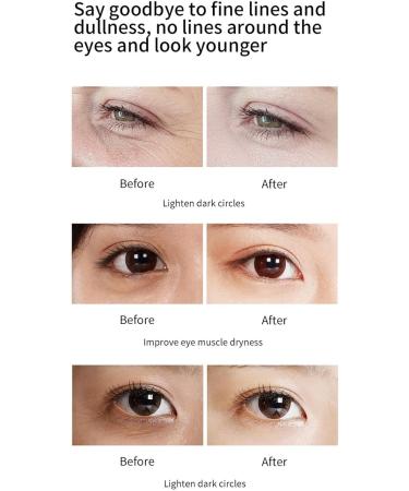 Retinol Eye Cream Stick | Eye Balm Stick | 0.21 fl. Jingan Advanced Lightweight Hydrating Retinol Eye Cream Stick for Dark Circles and Puffiness - Buy Online on GoSupps.com