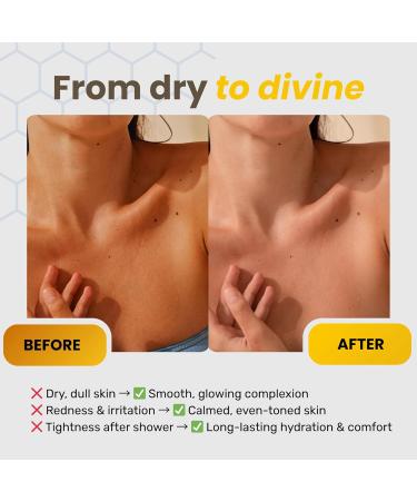 Organic Honey Luxury Body Wash | Real Honeycomb Pieces Royal Jelly & Propolis | Aloe & Rosemary Extract | Paraben Phthalate & Sulfate Free Shower Bath Gel | All Natural Soft Skin Bodywash - Buy Online on GoSupps.com