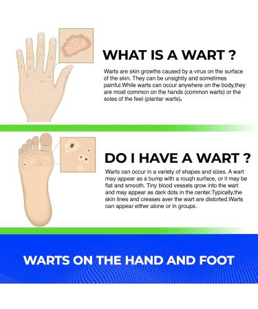 Liquid Wart Remover | Fast-Acting Advanced Treatment for All Wart Types - Painless Solution for Common & Genital Warts - International Shipping Available - Buy Online on GoSupps.com