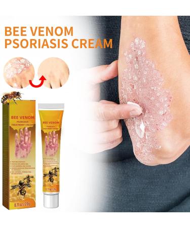 Bee Venom Psoriasis Treatment Cream - Soothing and Moisturizing | Professional New Zealand Formula for All Skin Types (1pcs) - Buy Online on GoSupps.com