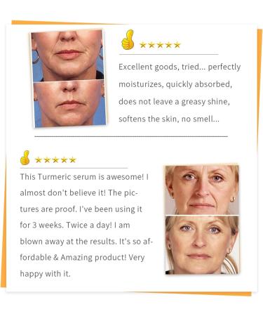 Beslibate 2 Pieces Turmeric Oil 30ml Turmeric Serum Turmeric Power Against Age Spots Natural Turmeric Skin Whitening Oil for Fight Acne Heals Scars Turmeric Skin Care Serum3 1 - Buy Online on GoSupps.com
