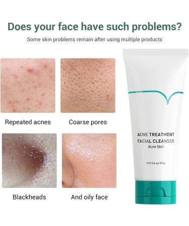 Facial cleanser 137 g cleanser for men morning routine and evening after training for makeup for travel and weekly care - Buy Online on GoSupps.com