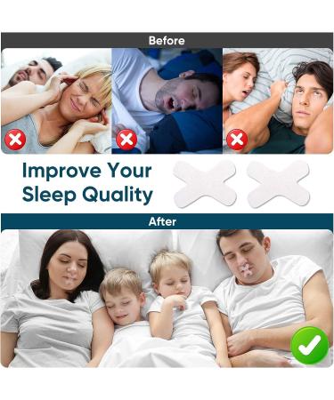 Gentle Sleep Tape for Better Sleep Quality | Anti-Snoring Mouth Strips - Buy Online on GoSupps.com