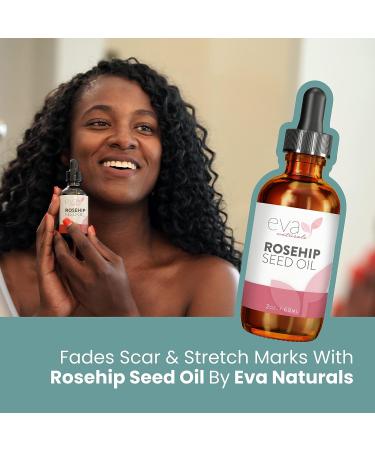 Organic Rosehip Seed Oil (2 Fl Oz) for Face - Stretch Mark & Scar Removal, Reduces Inflammation & Boosts Collagen Production - Radiant Skin & Facial Oil - Buy Online on GoSupps.com