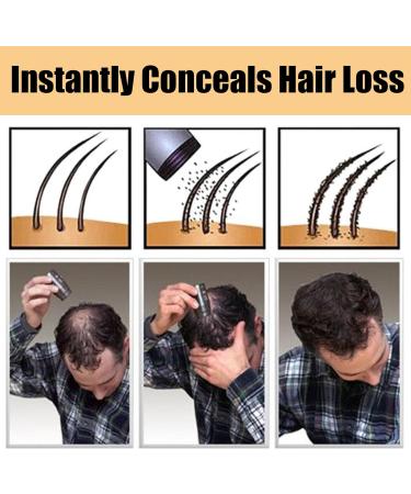 Hair Building Fibers Natural Hair Fibers for Men & Women Hair Fibres Dark Brown Hair Powder for Thinning Hair Easily Cover & Waterproof Hair Loss Concealer Instantly Conceals Hair Loss Soft Powder - Buy Online on GoSupps.com