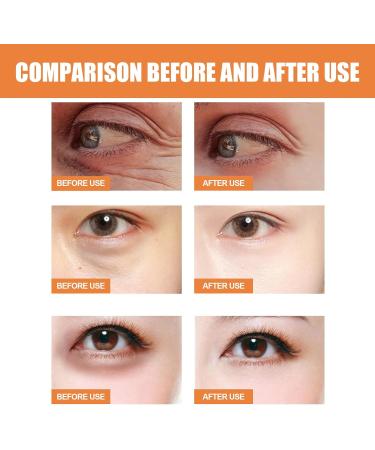 QGuoJie Lutein & Vitamin C Rollerball Eye Serum Oil AntiAging Essence for Dark Circles Puffy Eyes & Wrinkles Lightens Under Eye to Reduce Bags & Seize Serum 2 - Buy Online on GoSupps.com