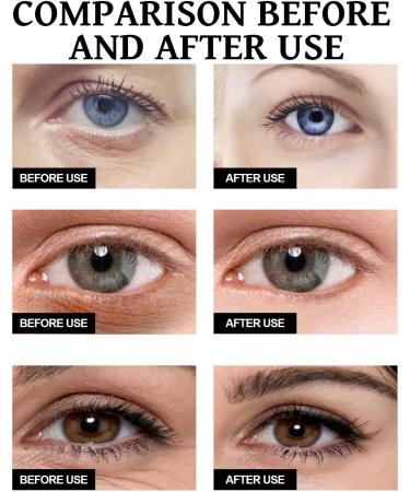 Multi-Peptide Eye Serum Under Eye Serum Anti Aging Eye Cream for Dark Circles and Puffy Eyes Eye Serum for Puffy Eyes Eye Bags Remover Smoothing Eyes Skincare for Fine Lines Firming Eye Cream - Buy Online on GoSupps.com