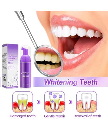 GFOUK Oral Crystal Cleansing Mousse - Tooth Mousse & Stain Removal Foam Purple Toothpaste for Whitening & Caries Prevention (2 Pieces) - Buy Online on GoSupps.com