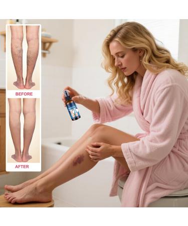 Muscle Spray - 30ml Relieves Muscles Deep Penetration Soothing Spray for Joint Discomfort | For Men and Women Back Neck Knee and Knee - Buy Online on GoSupps.com