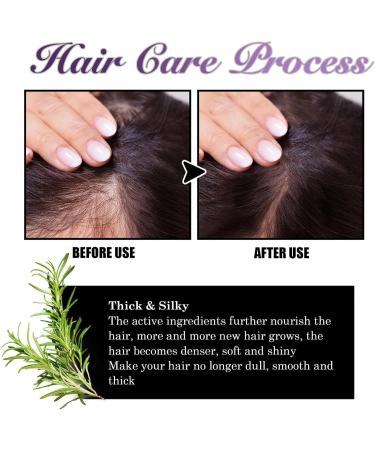 Organic Onion Oil for Hair Growth - Rosemary Hair Growth 1.0 FL.Oz Women Men Scalp Care Hair Regrowth Products for Healthy Hair - Buy Online on GoSupps.com