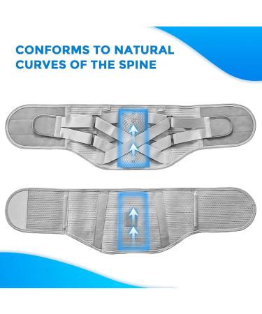Back Brace for Men and Women Back Support Belt for Lower Back Pain Relief Scoliosis Sciatica Herniated Disc Heavy lifting Lightweight Breathable Lumbar Support with Dual Adjustable Straps (Medium) - Buy Online on GoSupps.com