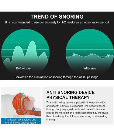 Electric Anti Snoring Device - USB Household Portable Solution for All Nose Shapes - Buy Online on GoSupps.com