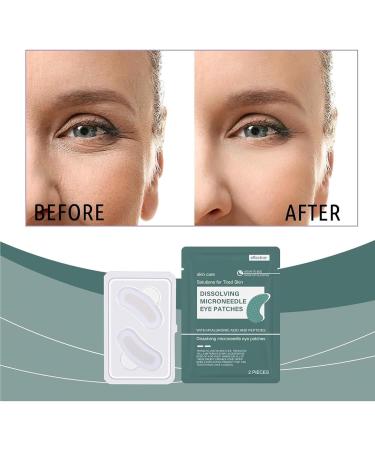 Patchs Oculaires -aiguilles R duit Les Rides Et Les Poches Patches Pour LesYeux Naturelles Tampons De Refroidissement De La Beaut Des Cernes Pour Le Soin Des Cernes Femmes Et Hommes - Buy Online on GoSupps.com