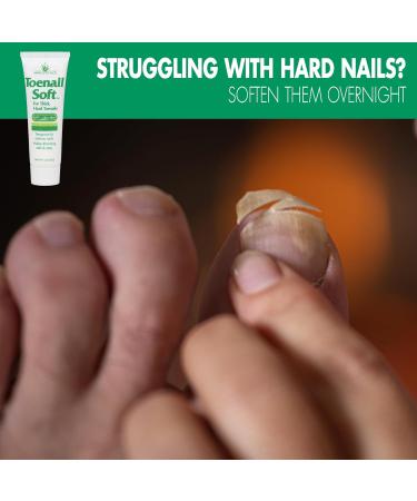 Toenail Softening Cream for Thick Hard Nails | Aloe Infused 1 Oz | Temporary Nail Care Solution - Shop Internationally - Buy Online on GoSupps.com